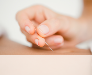 acupunctuur